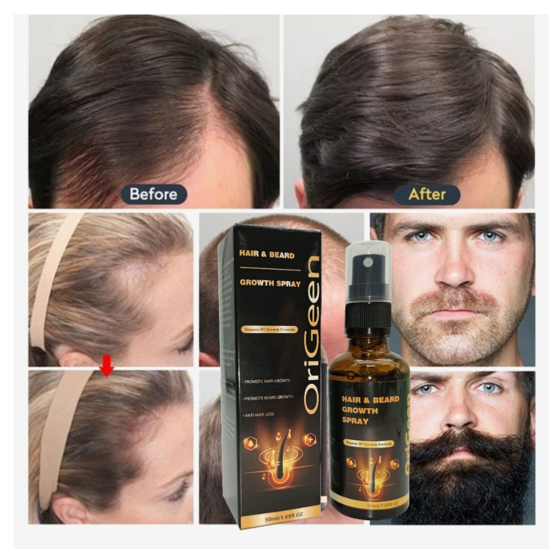 Origeen Haarserum - Hair groei stimulator- Tegen haaruitval - Baard groeimiddel - Baardgroei stimulator