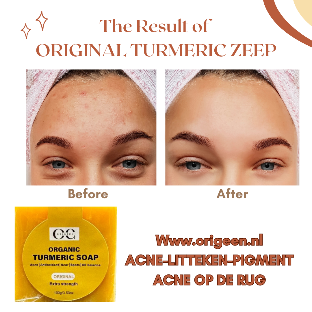Origeen Original turmeric soap - organic