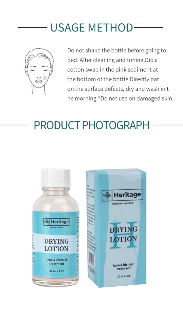 HERITAGE Anti-Acne drying lotion – De Ultieme Oplossing Tegen Puistjes, acnevlekken & Littekens | Verminder Ontstekingen & Versnel Herstel!