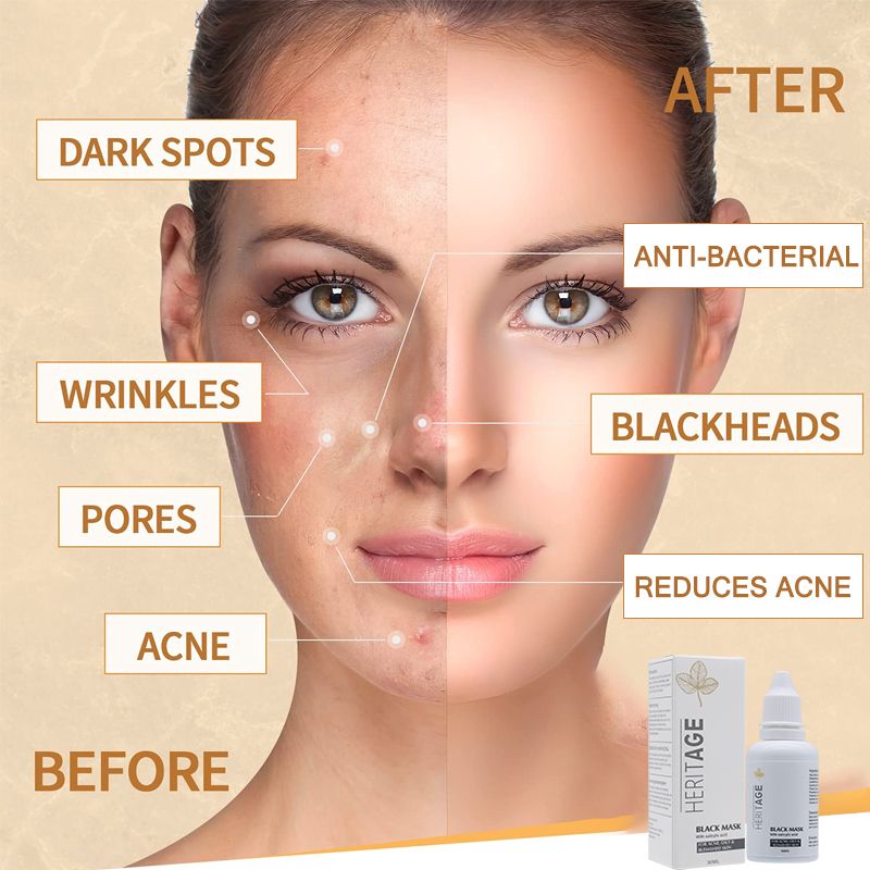 HERITAGE Black Mask – Diepreinigend Masker Tegen Acne, Ontstekingen & Sebum Balans – Voor een Zuivere en Gezonde Huid