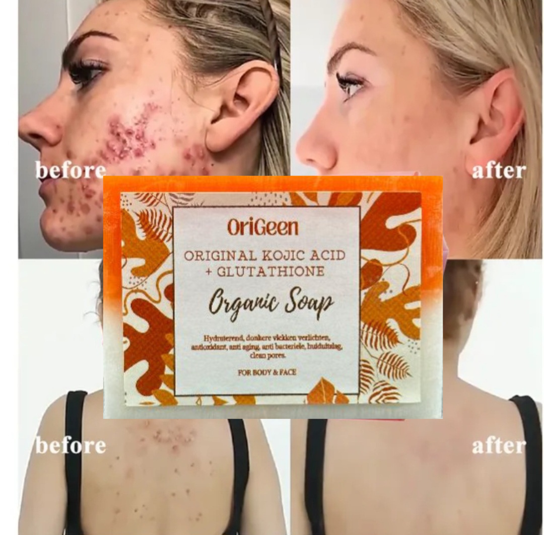 Glutathione & Kojic Acid Zeep – Organic & Original | Anti-Aging, Anti-Pigment & Antioxidant | Verheldert Donkere Vlekken, Reinigt Poriën & Vermindert Eczeem