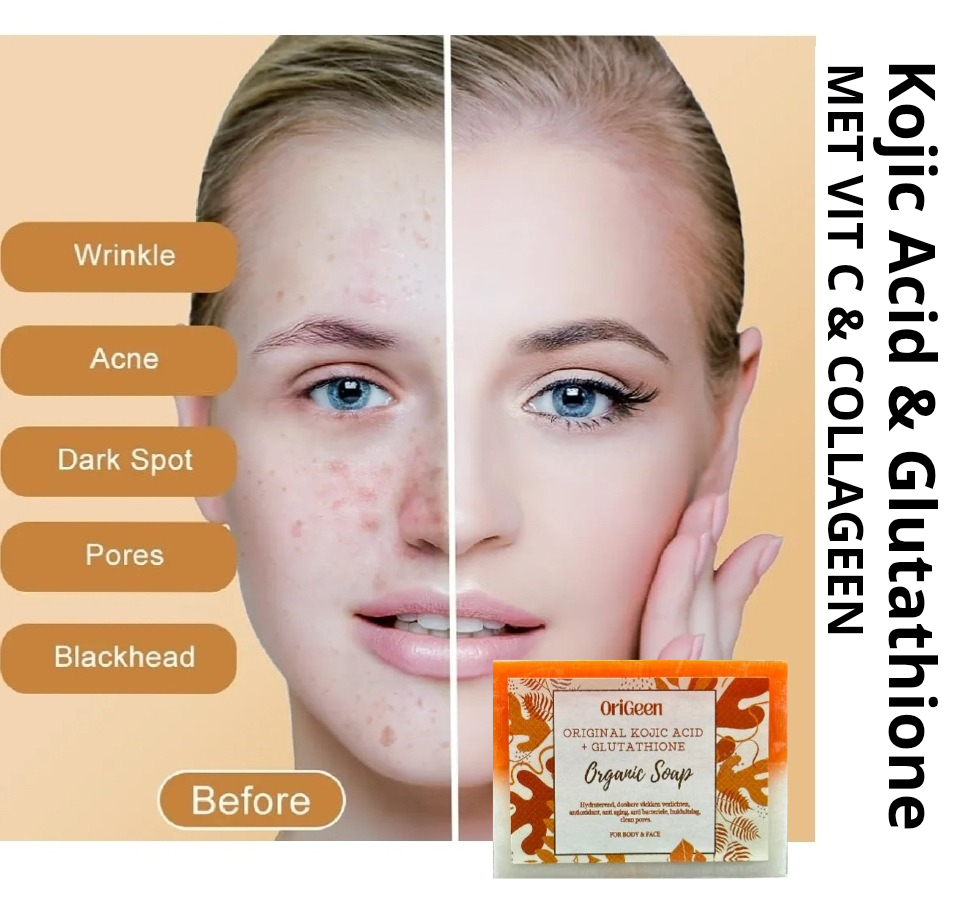 Origeen Glutathion & kojic acid zeep voor donkere vlekken en anti aging