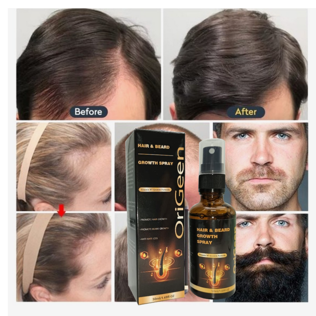 Origeen Hair and beard growth serum – Stimuleert Haargroei & Baardgroei | Tegen Haaruitval | Voor Dikker, Voller Haar & Een Sterke, Gezonde Baard