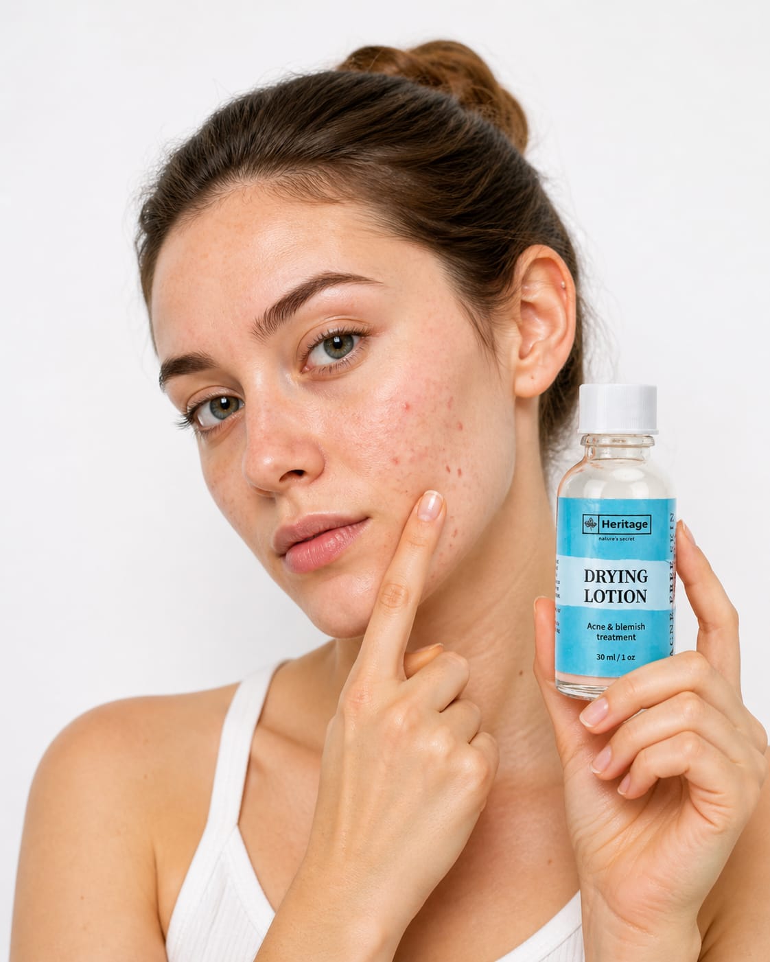 Acne gezicht masker