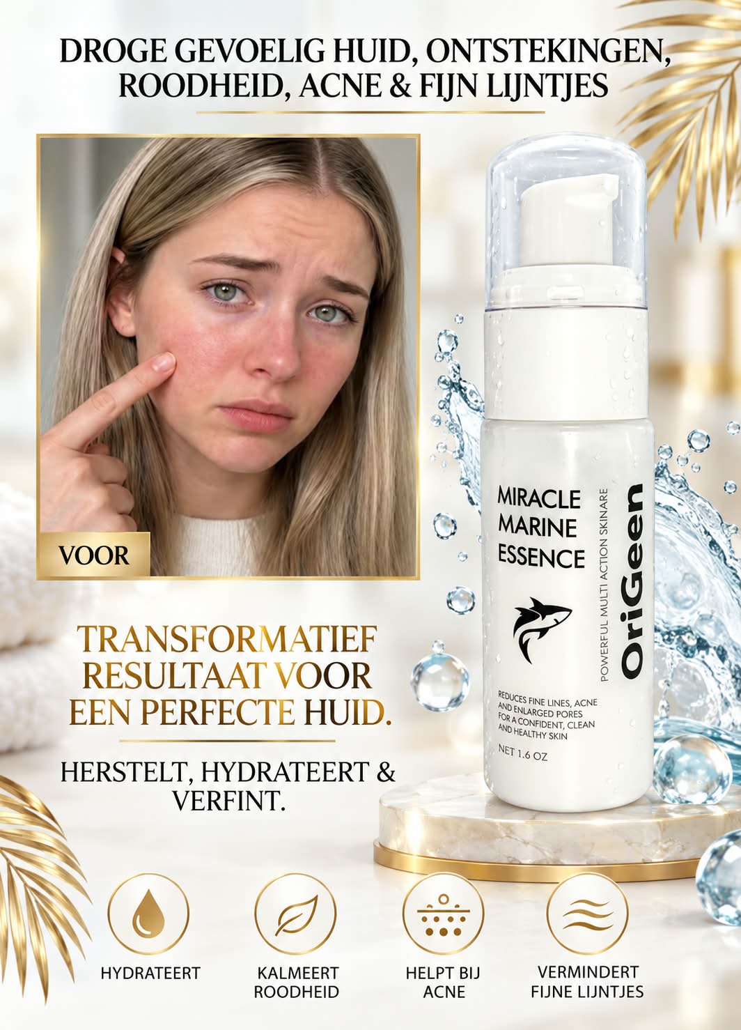Origeen all in Serum voor grove porien, droge huid, geiriteerde huid, roodheid, acne en fijn lijnthes